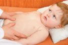 Аппендицит у ребенка: основные симптомы и современные методы лечения — рассказывает врач