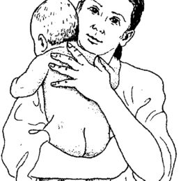 як тримати новонародженого з кривошиєю - фото 1