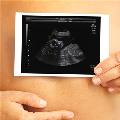 УЗИ во время беременности - фото
