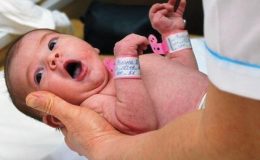 новорожденный, после родов, кефалогематома, родовые опухоли у ребенка, милии, сыпь, пузырьки на коже, гопотонус, гипертонус у ребенка, косят глаза у новорожденного