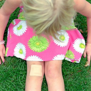 Ушиб колена у ребенка (фото: ЦФА Бурда)