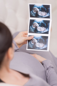 Беременная смотрит на фотографию УЗИ (фото Fotolia.com)