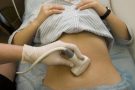 Как подготовиться к УЗИ при беременности
