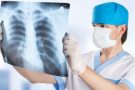 10 міфів про туберкульоз, в які пора перестати вірити — Уляна Супрун