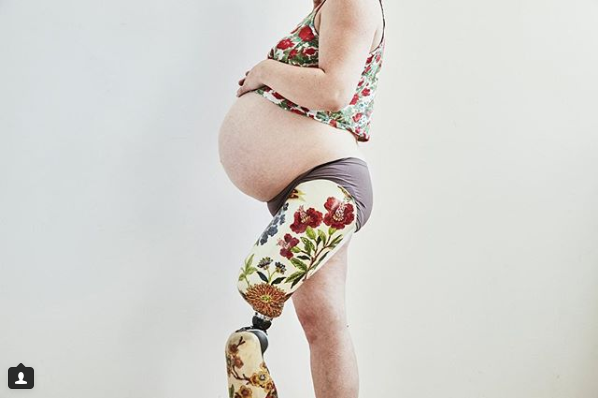 фотосессия беременной женщины с ампутированной ногой