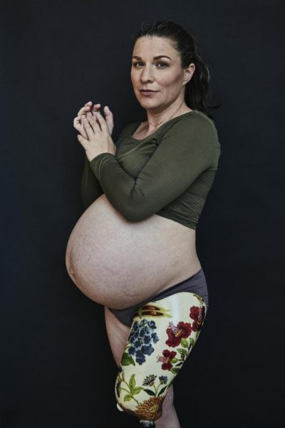 фотосессия беременной женщины с ампутированной ногой