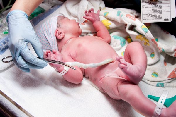 пуповина, роды, пресечение пуповины, перерезание пуповины, когда пресекают пуповину, чем перематывают пупок, как ухаживать за пупком новорожденного, уход и здоровье новорожденного ребенка