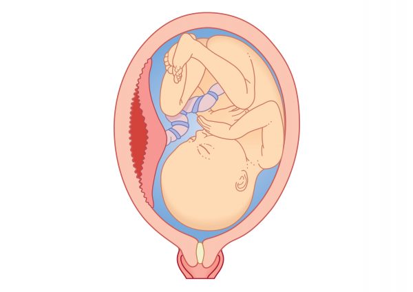 плодное место, беременность, выкидыш, анализы, роды, бесплодие, ЭКО, гормоны, плацента, плацентарная недостаточность, преждевременные роды, околоплодные воды, место, пуповина