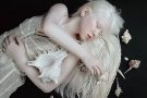 Красота вопреки: в семье родились девочки-альбиносы