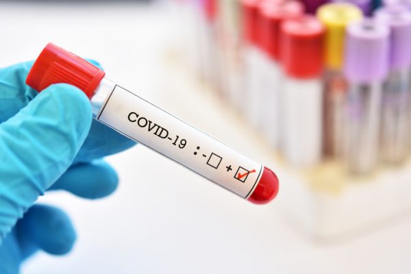 коронавирус, COVID-19, коронавирус в Украине, пик коронавируса в Украине