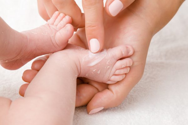 Атопічний дерматит у немовляти