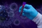 Ученые выяснили, когда коронавирус становиться более заразным